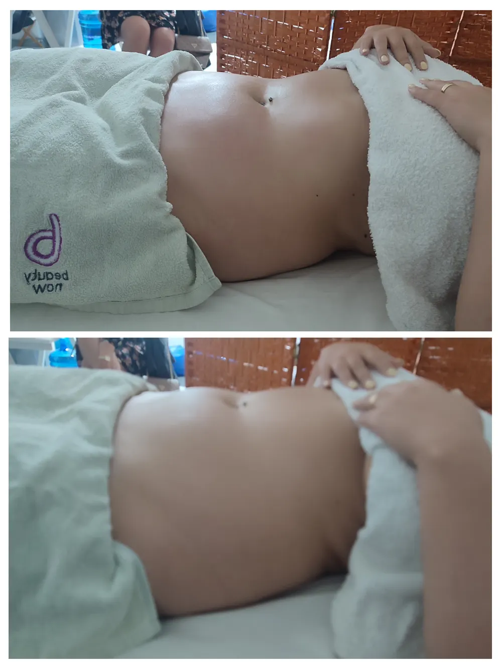 Resultado antes e depois - terapia descongestionante do trato gastrointestinal