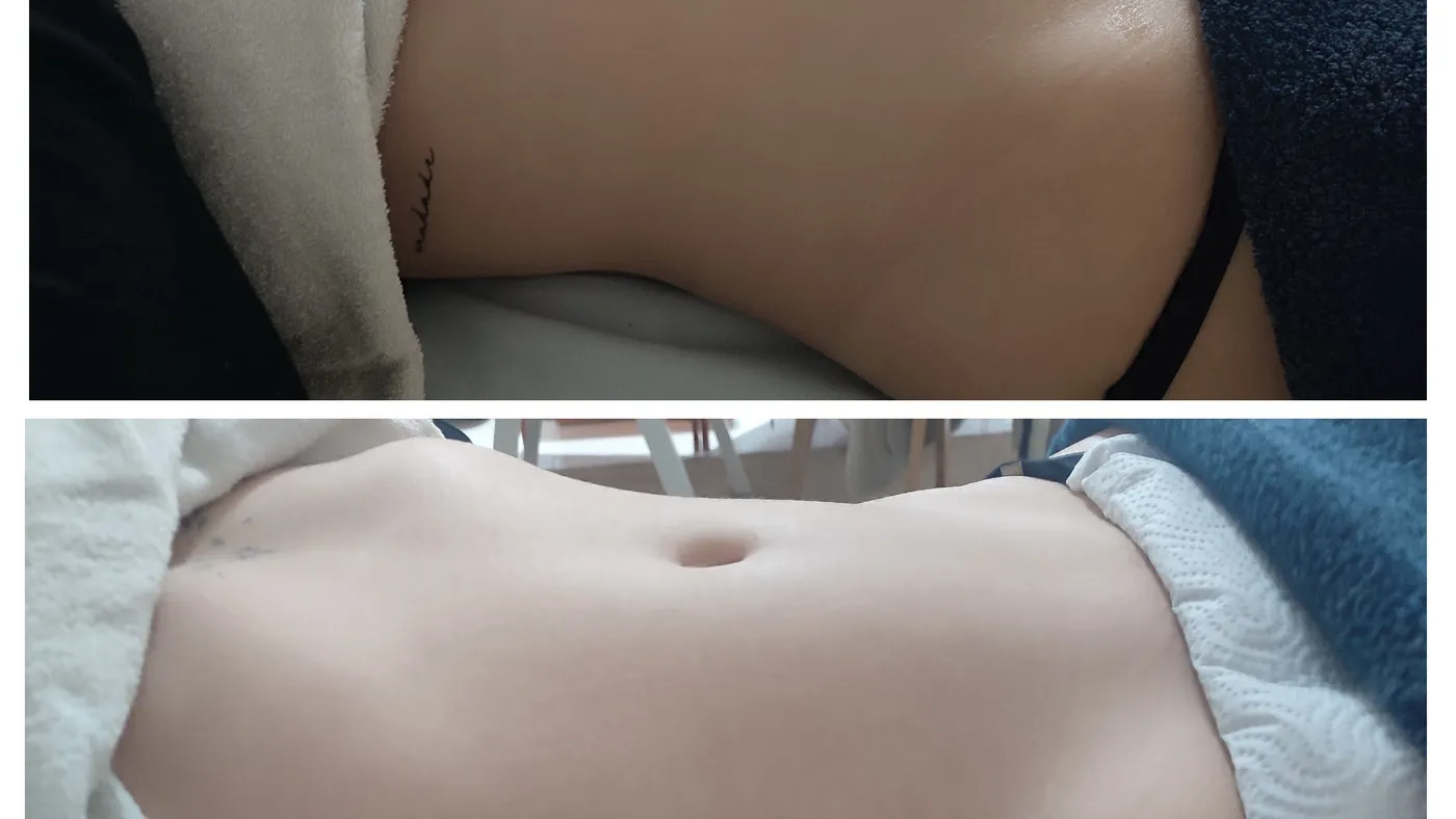 Terapia descongestionante do trato gastrointestinal